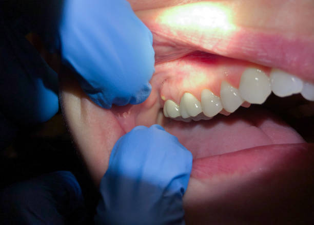 Best Orthodontic Emergency Dentist in Oquawka, IL
