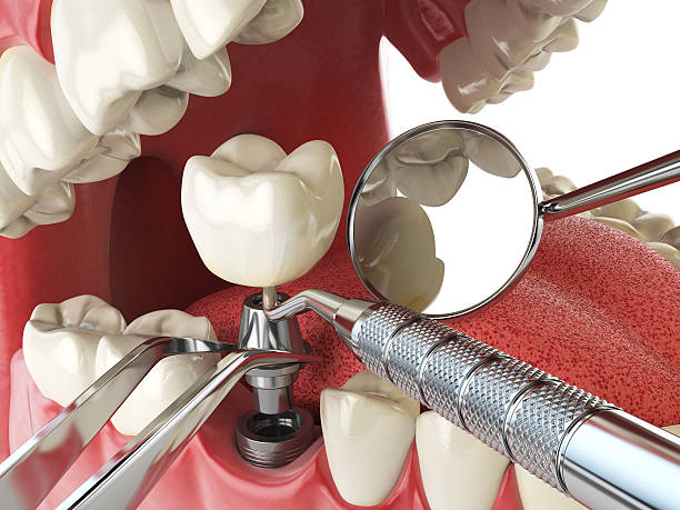 Best Emergency Dental Services for Seniors in Oquawka, IL